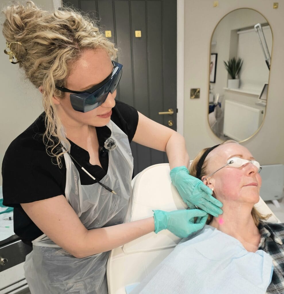 Endolift | The Calla Clinic | Derbyshire